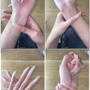 #208 - Scratching My Arms With My Long Claws