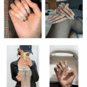 #1 - Photo Album - Mixed Photos Of Me And My Nails