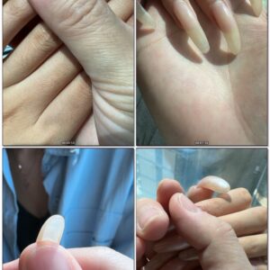 #429 - Close Up Touching My Natural Nails