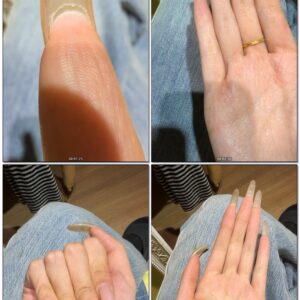 #449 - Close Up Of My Palms And Nail Undersides