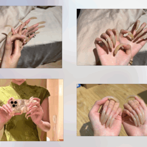 #6 – Photo Album – Over 3cm Long Natural Nails