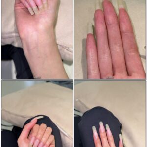 #1142 – Bright Showing Of My Long Nailbeds And Undersides